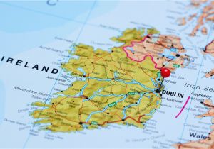 Detailed Map Of northern Ireland Here are the Things that Must Happen before and after A United