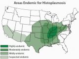 Map Of Ohio River and Mississippi River Histoplasmosis the Scourge Of the Ohio River Valley Precision