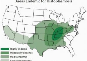 Map Of Ohio River and Mississippi River Histoplasmosis the Scourge Of the Ohio River Valley Precision