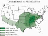 Map Of Ohio River Valley Histoplasmosis the Scourge Of the Ohio River Valley Precision